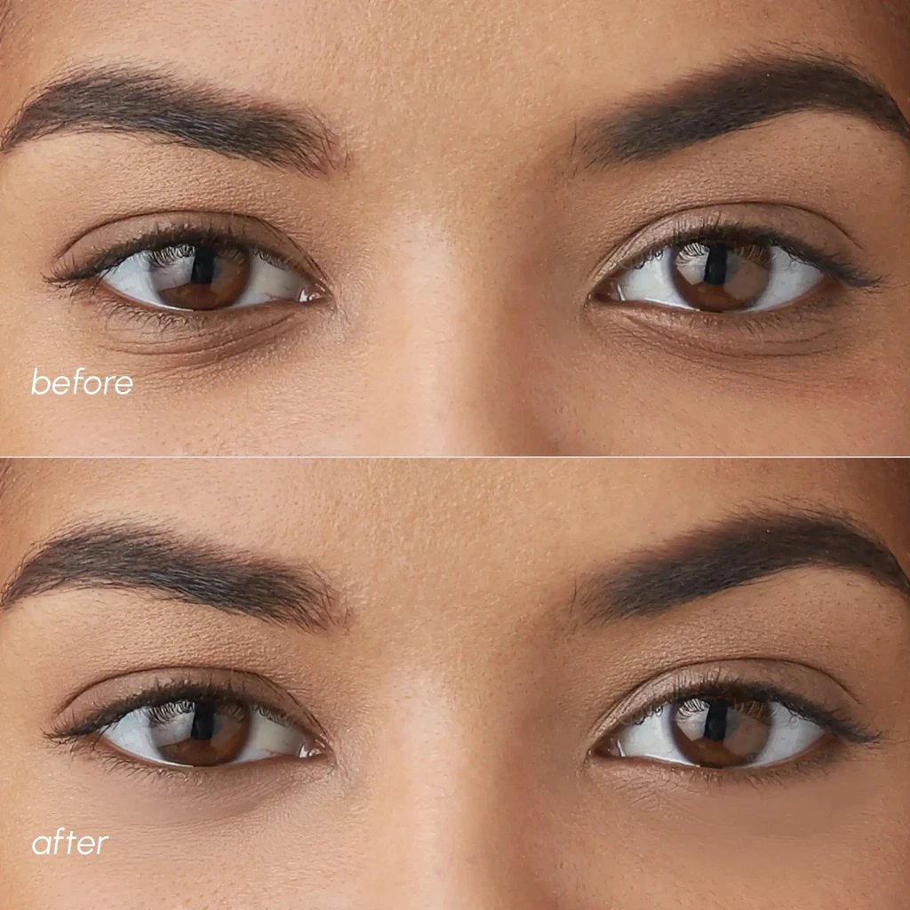 Maree Eye Patches for Dark Circles