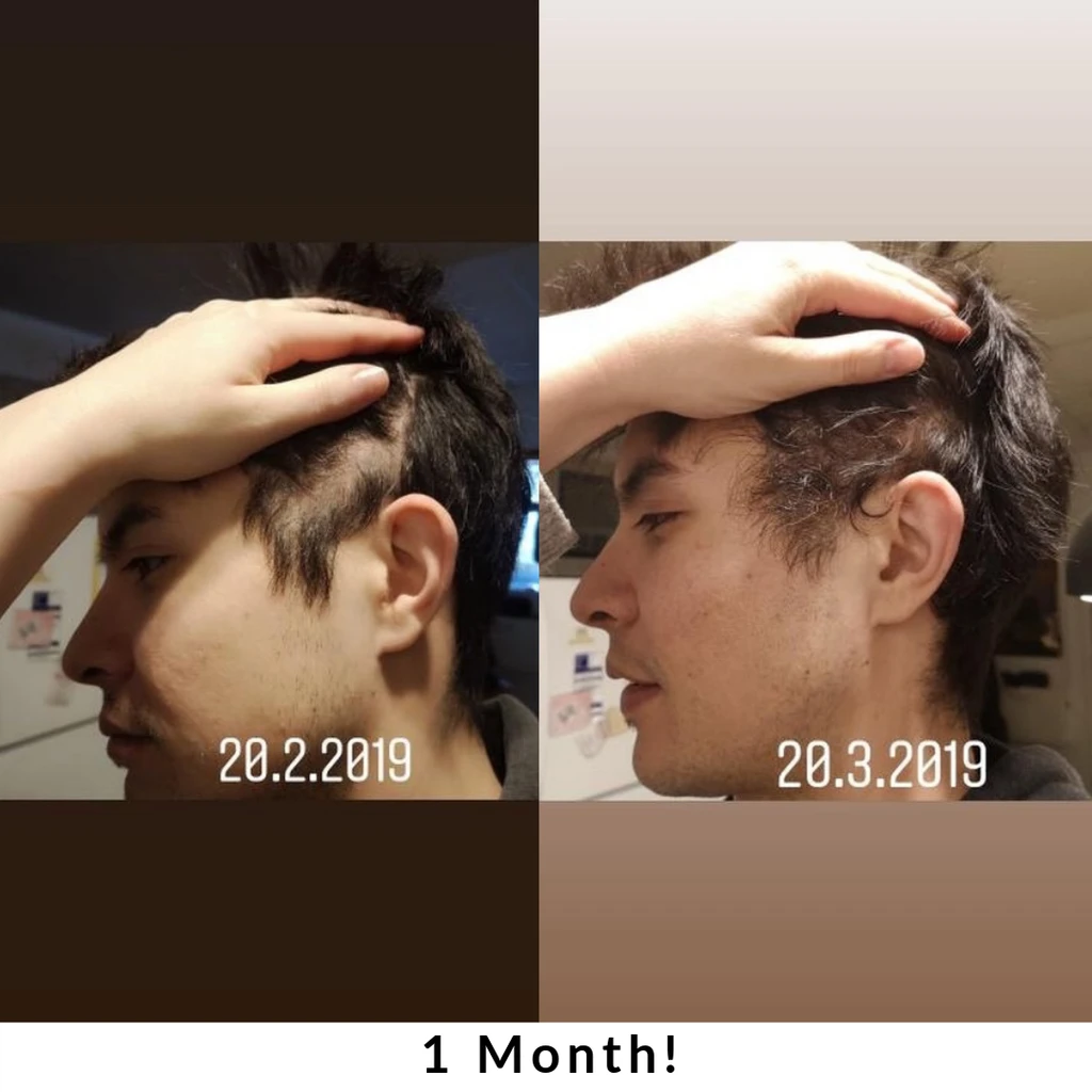 JSHealth Vitamins Hair + Energy Formula for Thicker, Stronger Hair